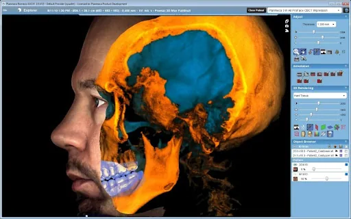CBCT Scan: 222