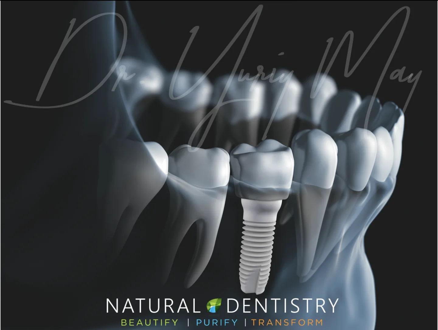 Ceramic Dental Implants Dentist Connecticut NY NJ MA RI VT USA