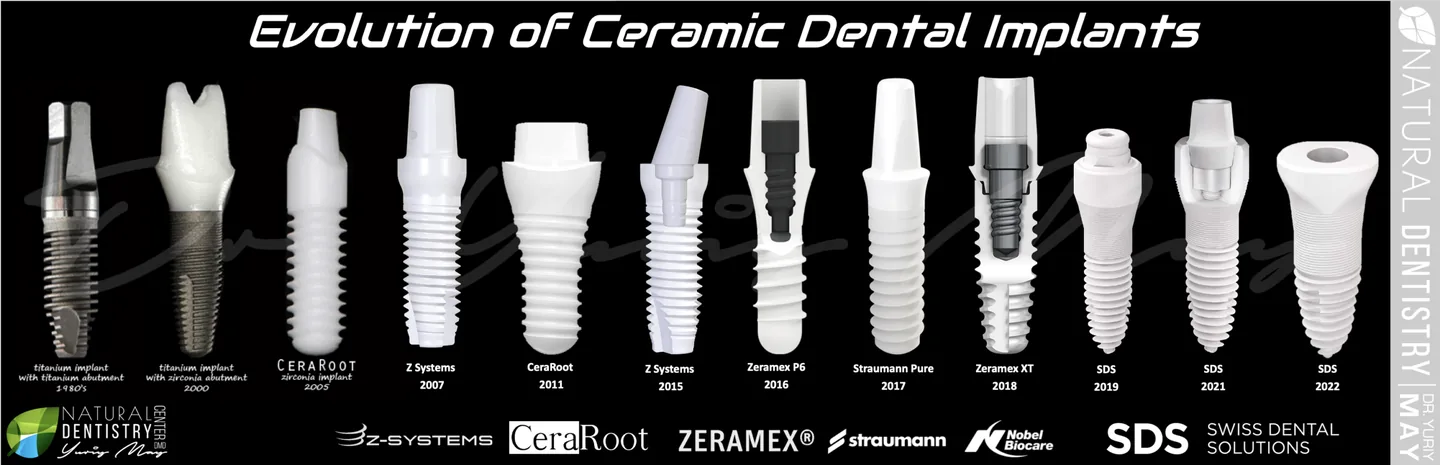 ceramic dental implants: History of Zirconia Dental Implants Dr. May
