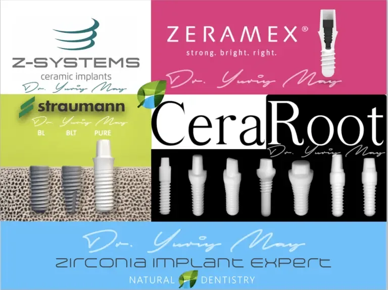 ceramic dental implants: Zirconia Dental Implants Expert Dr. May 768x575 1