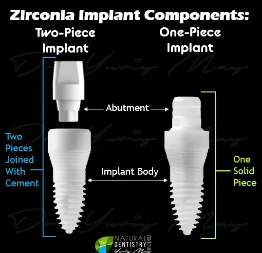 ceramic dental implants: Zirconia Implants 2 Piece vs 1 Piece Ceramic Implants Natural Dentistry Dr. Yuriy May SDS Implants