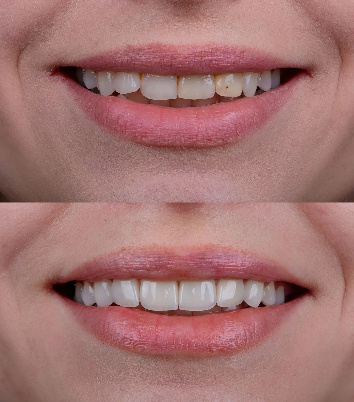 cosmetic dentistry 1 1