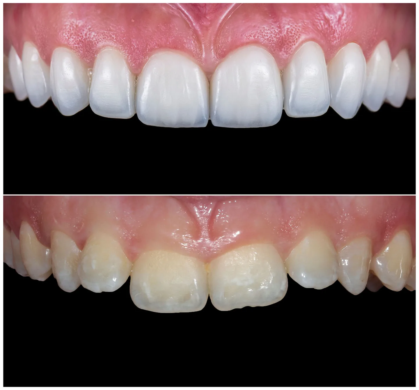 cosmetic dentistry 1