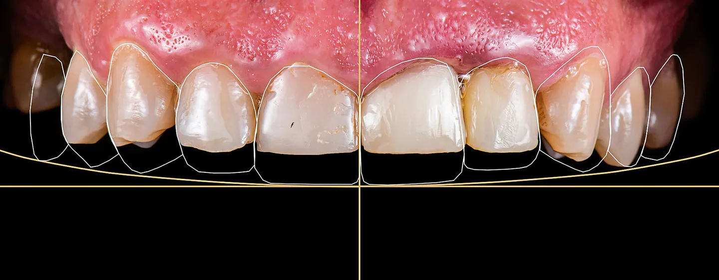 cosmetic dentistry 2