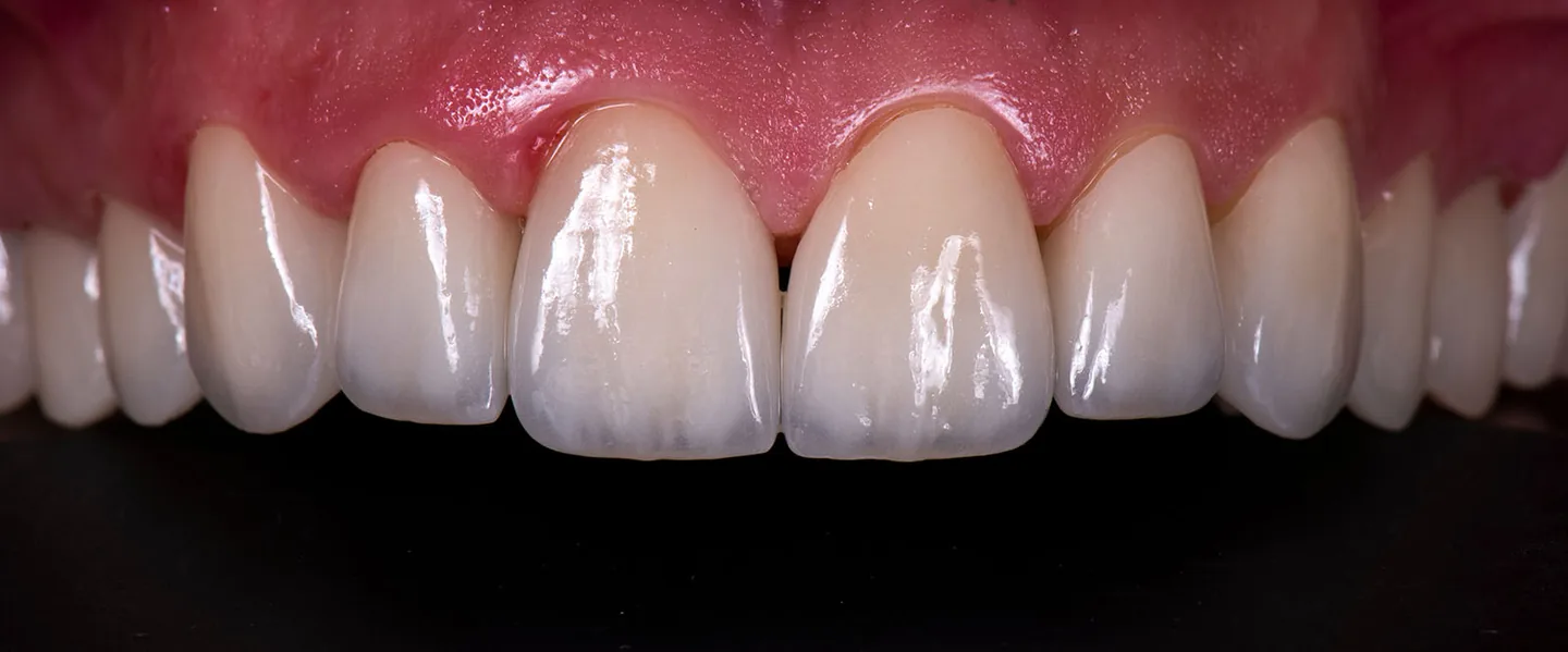 cosmetic dentistry 3 1