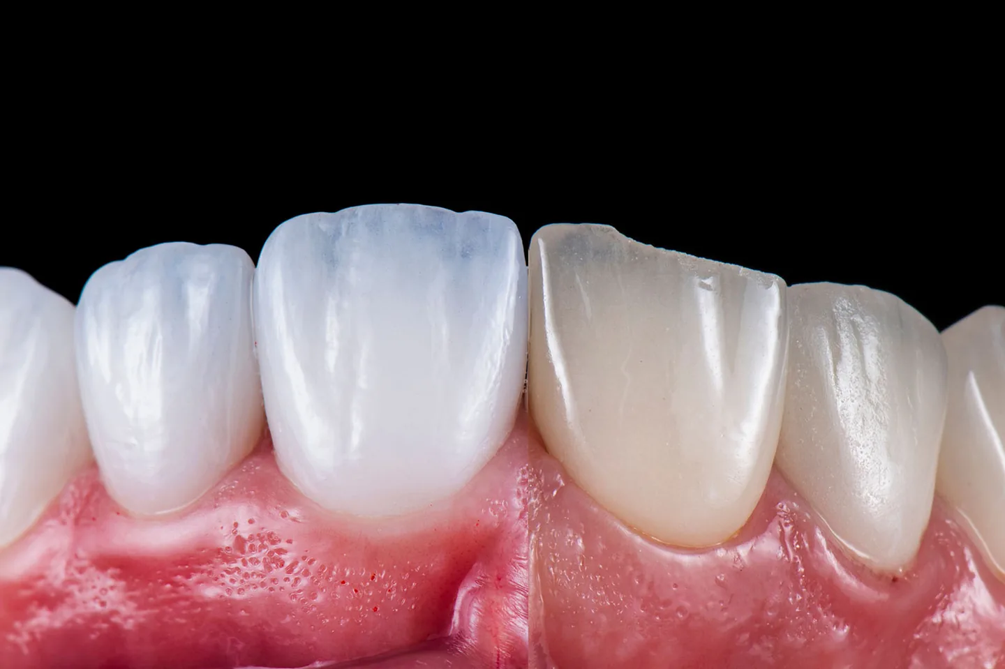 cosmetic dentistry 4