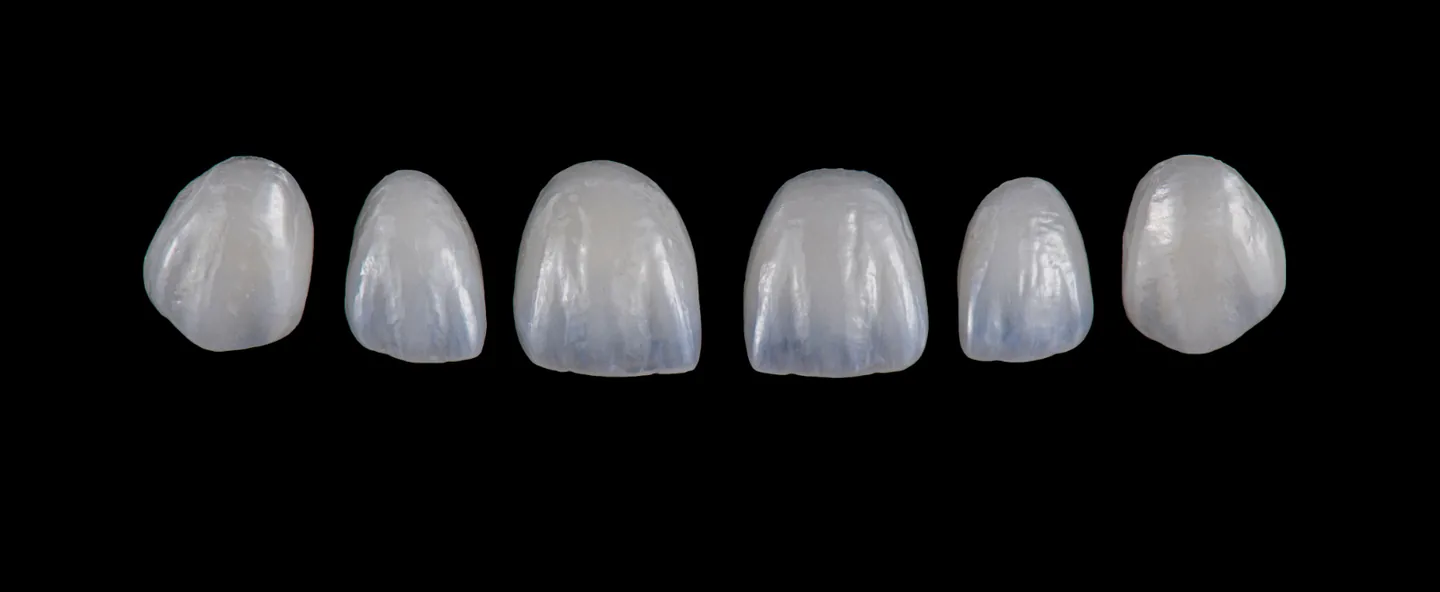 Cosmetic Dentistry: image 6